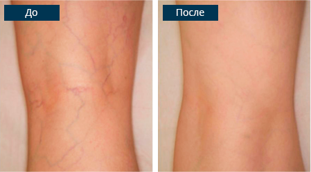 Елена Артемьевна (г. Курск)