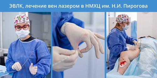 Как проводится ЭВЛК Как проводится ЭВЛК